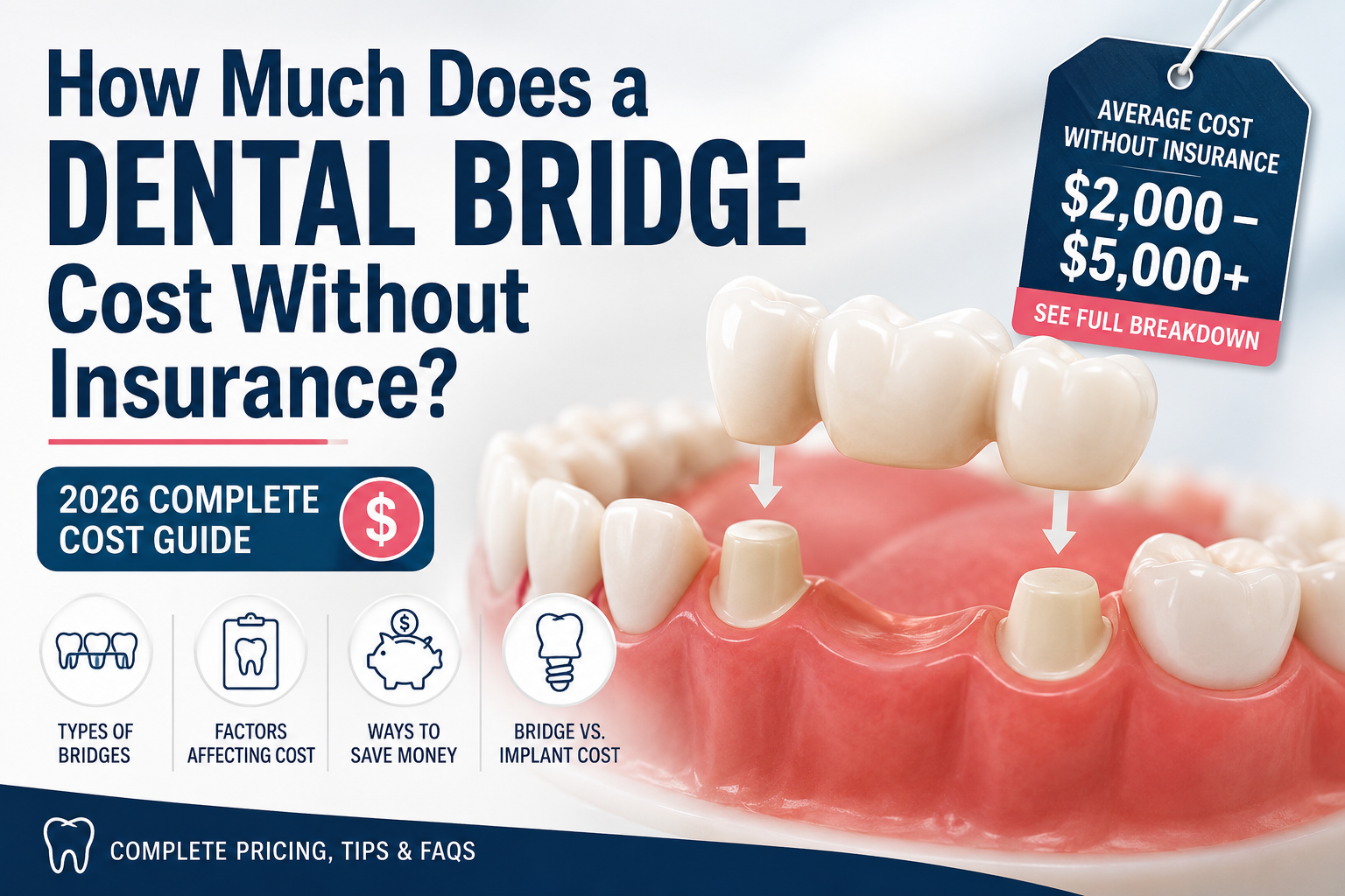 How Much Does a Dental Bridge Cost Without Insurance